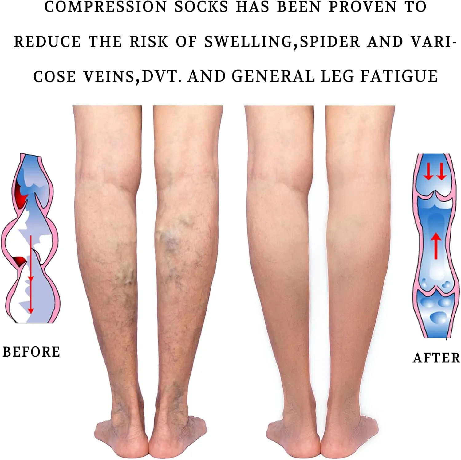 LIN PERFORMANCE 20-30 mmHg Medical Compression Socks for Women and Men Knee High Open Toe Stockings for Varicose Vein Swollen legs (M,White)